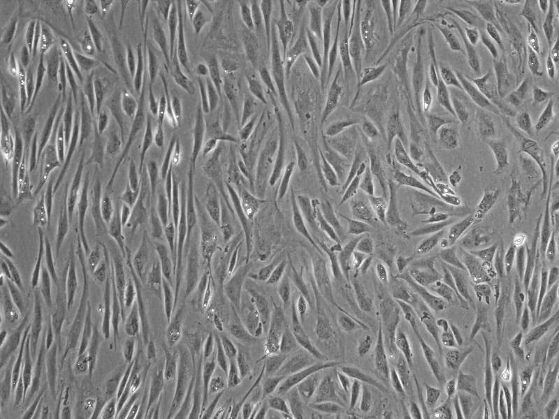 低氧环境下间充质干细胞治疗自身免疫病新机制被揭示.jpg
