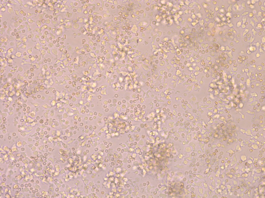 1767682026377131.jpg 2025外周免疫细胞.jpg